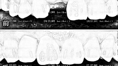 泰康拜博口腔医院靠谱吗？泰康拜博口腔种植牙多少钱？附介绍