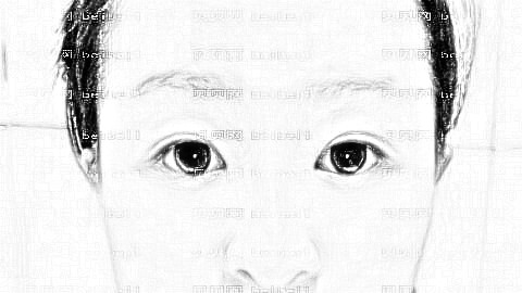 假体隆鼻可以捏鼻子吗?假体隆鼻多久可以随便碰?