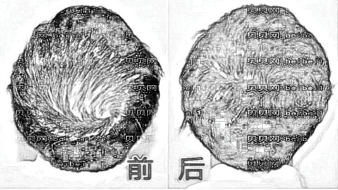 南京大麦微针医院发际线植发多少钱？附,植发医生