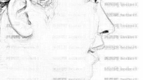 膨体隆鼻一个月高度定型了吗?膨体隆鼻会变矮吗?