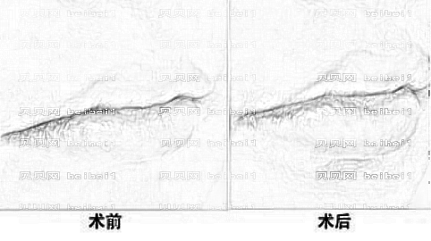 襄阳韩美整形医院怎么样？专家介绍|地址|电话+全新揭秘