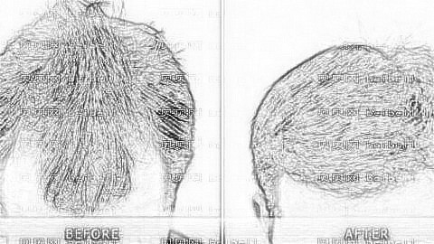 重庆迪邦医院植发怎么样？靠谱吗？迪邦植发收费高吗？附介绍