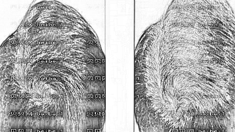 贵阳植发哪家医院好？多少钱？附贵阳植发医生排名名单