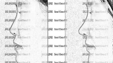 临沂隆鼻哪家医院好？揭秘临沂隆鼻医生排名前五榜单|附介绍