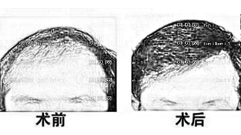 中山植发哪家医院好？多少钱？附中山植发医生排名名单