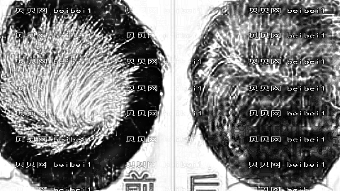 东莞科医能整形技术怎么样？,植发价格一览表！医生介绍