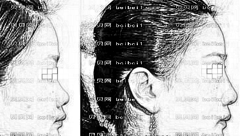 深圳千羽整形医院靠谱吗？,整形一览表！哪个医生技术好？