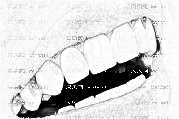 宁波市一院应彬彬怎么样_附应彬彬手术介绍