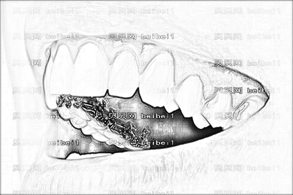 苏医附一院牙齿矫正_,牙齿矫正