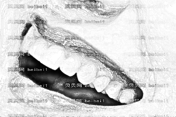 重庆附一院整牙怎么样