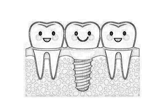 安医一院种牙怎么样_种牙会影响旁边的牙吗