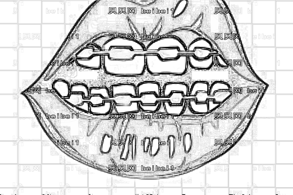北京同仁医院牙齿正畸做的好吗_牙齿正畸介绍