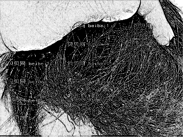 南方医科大学南方医院的苗勇脱发植发多少钱【价格查询】