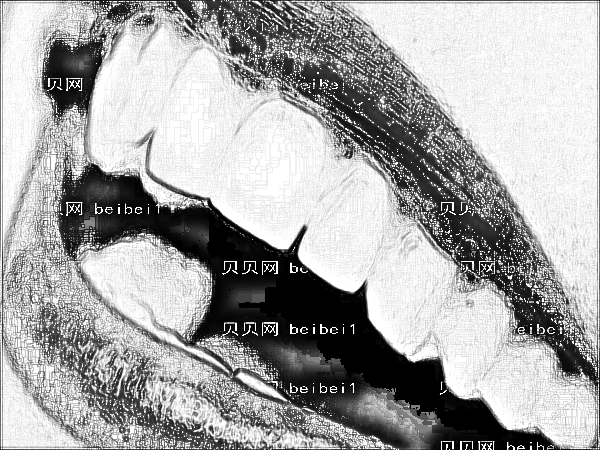 2022上海种植牙哪家医院做的不错?上海种植牙排名前三有哪些