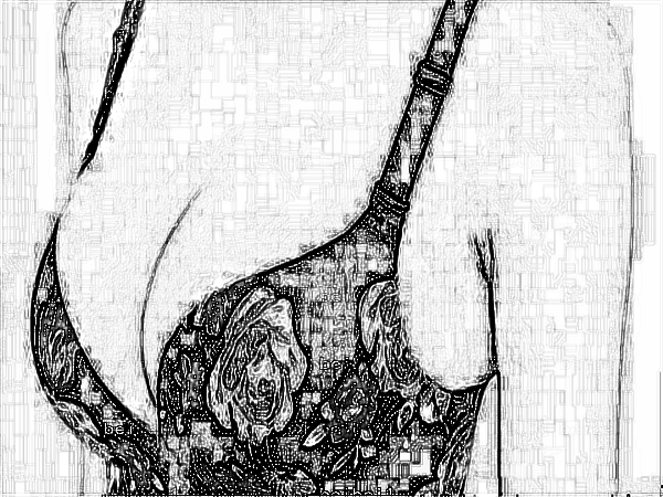 医学科学院整形外科刘春军自体脂肪注射隆乳怎么样？多少钱？