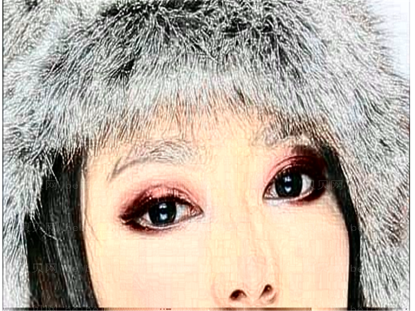 深圳港美双眼皮失败修复哪个医生好?果好吗?
