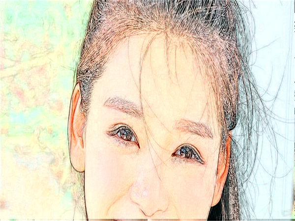 深圳港美双眼皮失败修复果怎么样？附介绍和价格