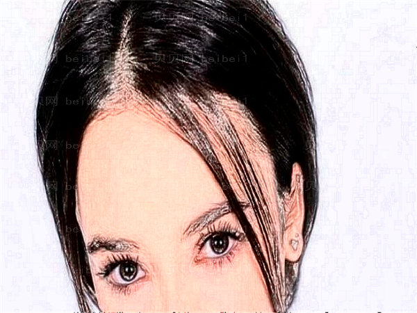 杭州美莱开眼角价格_开眼角开的是哪里