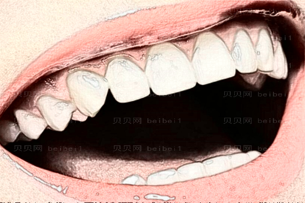 重庆世纪美奥口腔医院做的好吗?牙齿矫正介绍