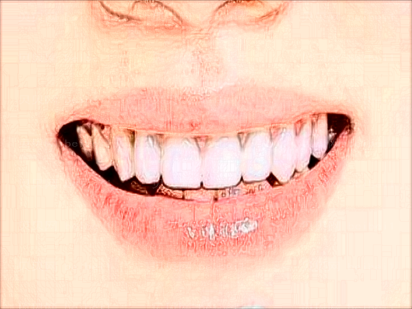 青岛牙博士口腔门诊部牙齿稀疏做的好吗?好的医生名单