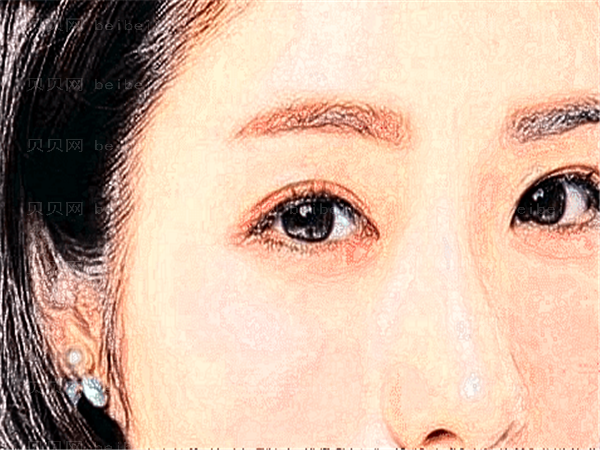 杭州同荣丽格丰太阳穴怎么样?有副作用吗?