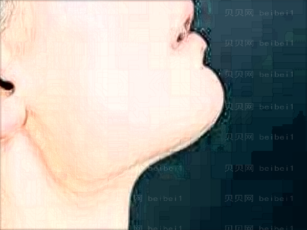昆明娇点自体脂肪填充收费价格一览_不贵还靠谱