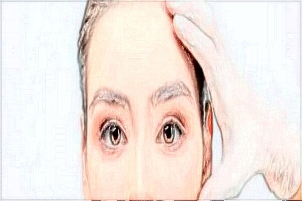 去法令纹要注意什么?去法令纹要多少钱