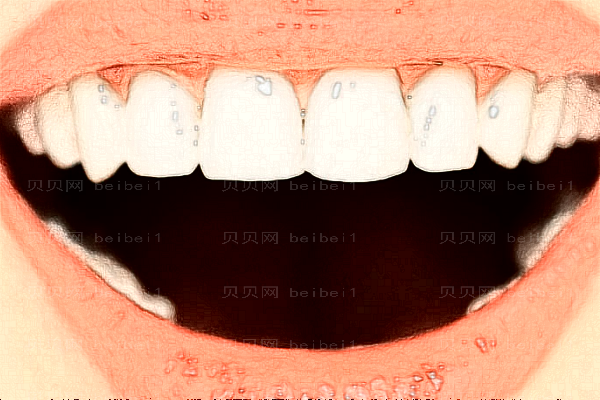 牙齿美白可以做哪些项目?牙齿美白可以保持多长时间