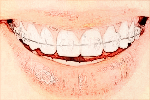 广州牙齿矫正口腔专家介绍+前八牙齿矫正整形医生名单