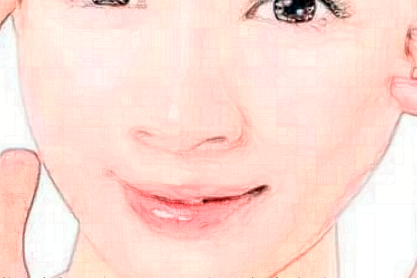 中山美南华玻尿酸医生好吗?医生名单