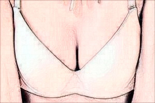 合肥巨乳缩小整形专家介绍(前六都是实力派医生)