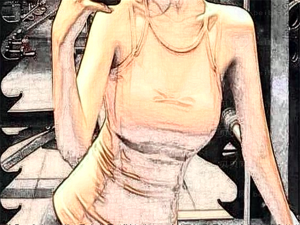 乌鲁木齐去副乳整形专家介绍(前四名单有哪些)