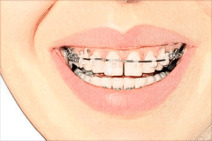 孝感中尚口腔牙齿矫正哪些医生好?技术好的医生推荐