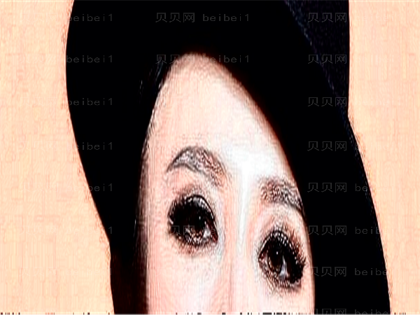 成都爱迪眼科近视眼手术价位高吗?医生名单揭晓