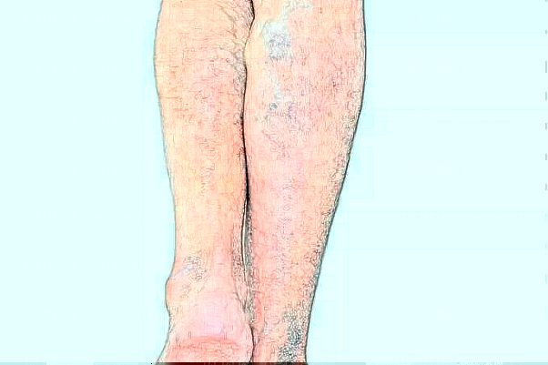 兰州吸脂瘦大腿比较好的医生提名|全新医生介绍揭秘