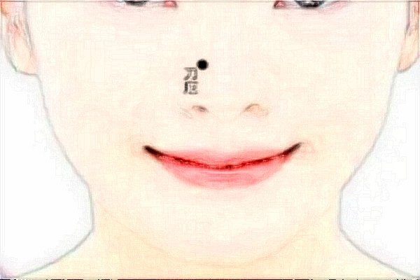 宜昌颜图假体隆鼻前二名的医生