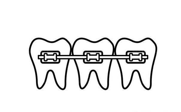 贵阳地包牙矫正那个医生做的好