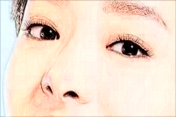 蚌埠东方美莱坞肋软骨隆鼻哪位医生做的好