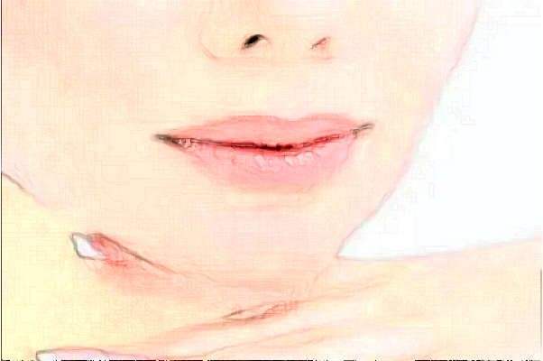 铜仁华美去双下巴找哪位医生做的好