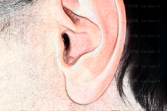 全耳再造手术需要多长时间？