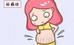 沈阳去妊娠纹有实力的医生公开