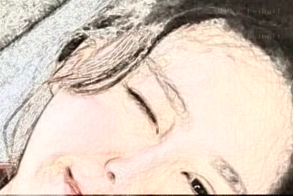 东莞华美冷冻去痣会不会复发？