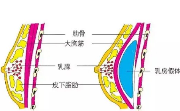 恩施假体隆胸技术好的医生有哪些