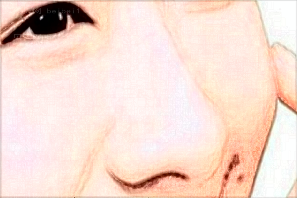 深圳鹏爱秀琪超微小气泡李莉医生怎么样？