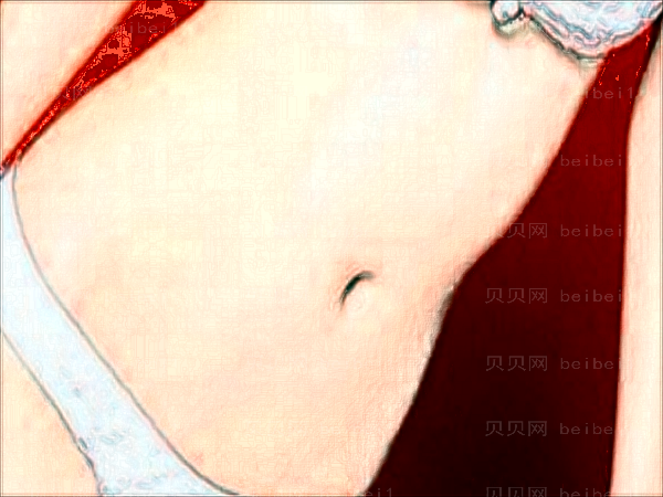 东莞长安安美腹壁成形术怎么样?