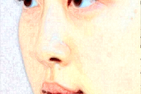 成都武侯素美膨体隆鼻卢元刚医生好不好？