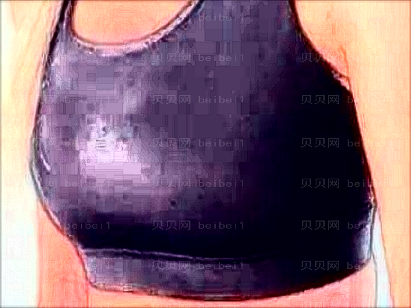 深圳南雅真皮固定矫正乳房下垂何奇医生怎么样？
