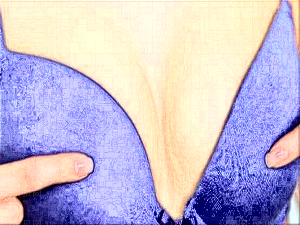 长沙申美自体脂肪隆胸好不好？