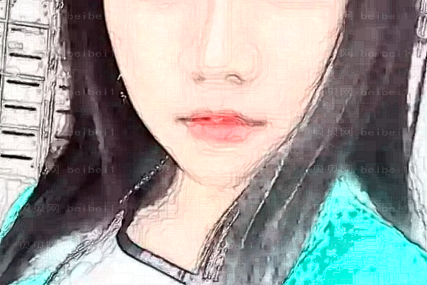 上海华美V-line瓜子脸怎么样？