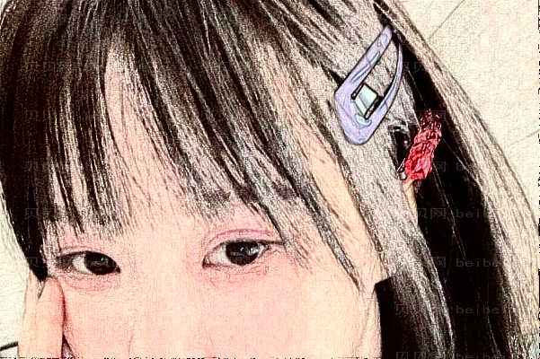 佛山美莱激光祛色素病好不好？